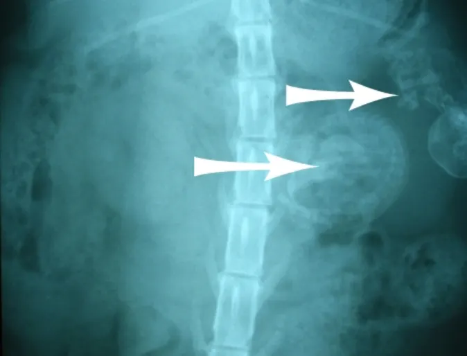 X-ray of cat fetuses in cat's abdomen X-ray of cat fetuses in cat's abdomen