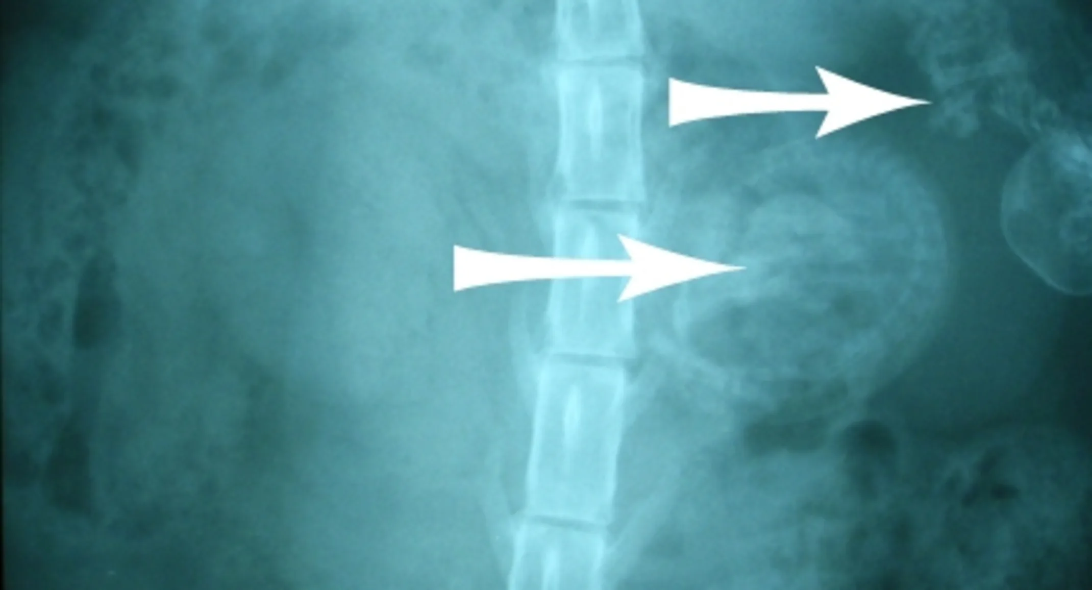 X-ray of cat fetuses in cat's abdomen X-ray of cat fetuses in cat's abdomen