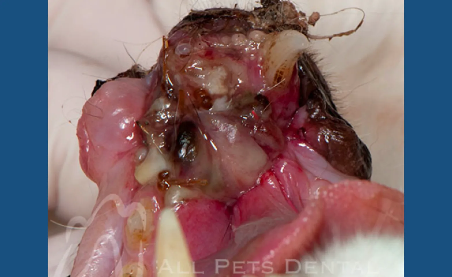 Fractured Jaw Fractured Jaw
