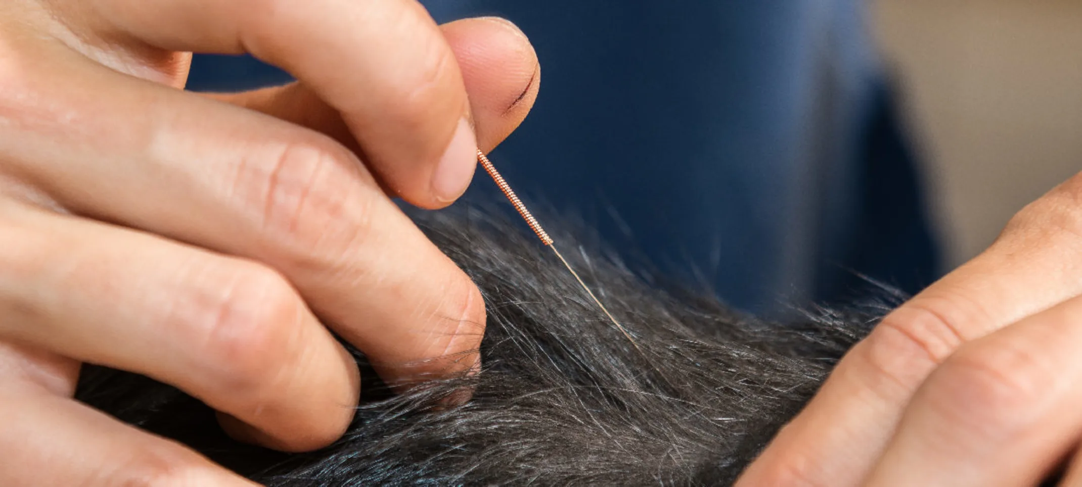 A close view of a veterinary professional performing acupuncture on a pet