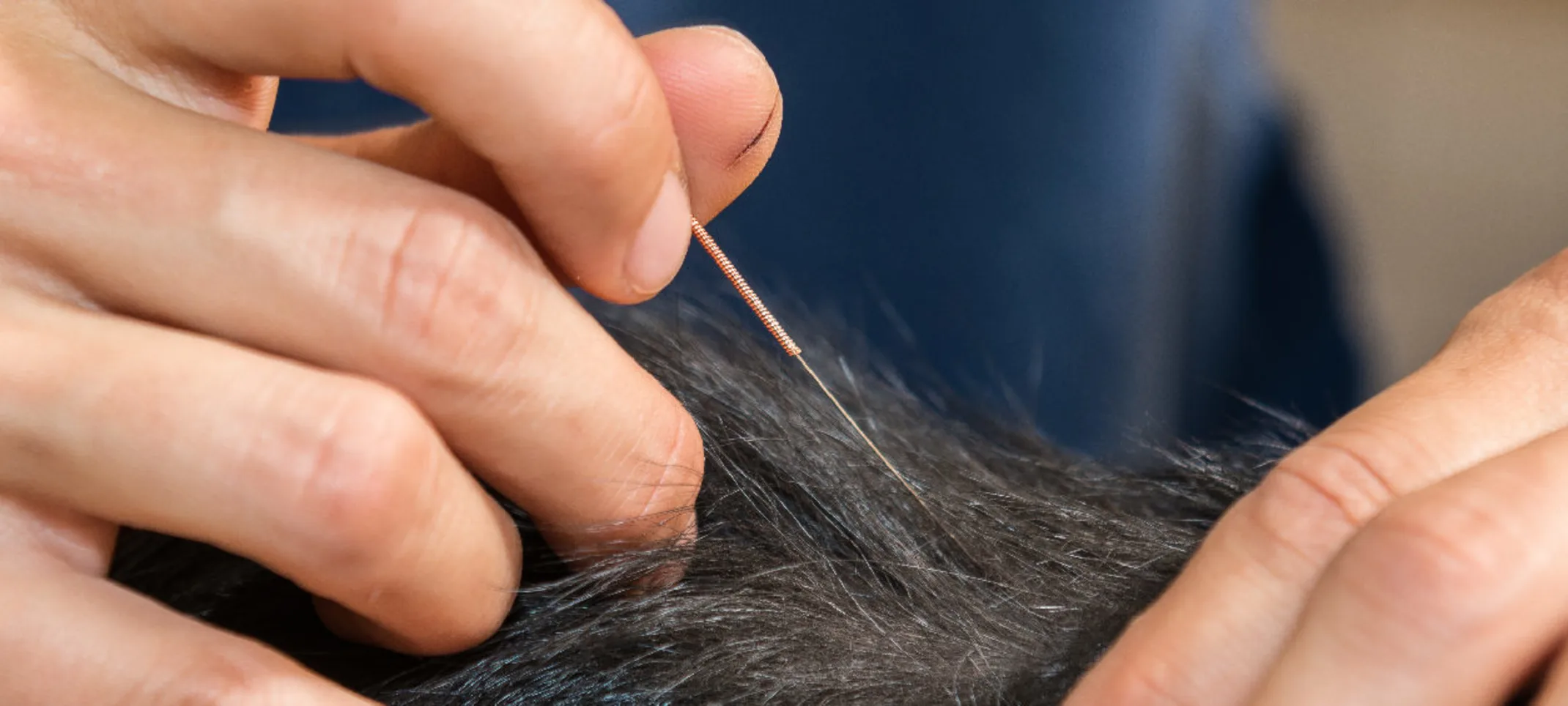 A close view of a veterinary professional performing acupuncture on a pet A close view of a veterinary professional performing acupuncture on a pet