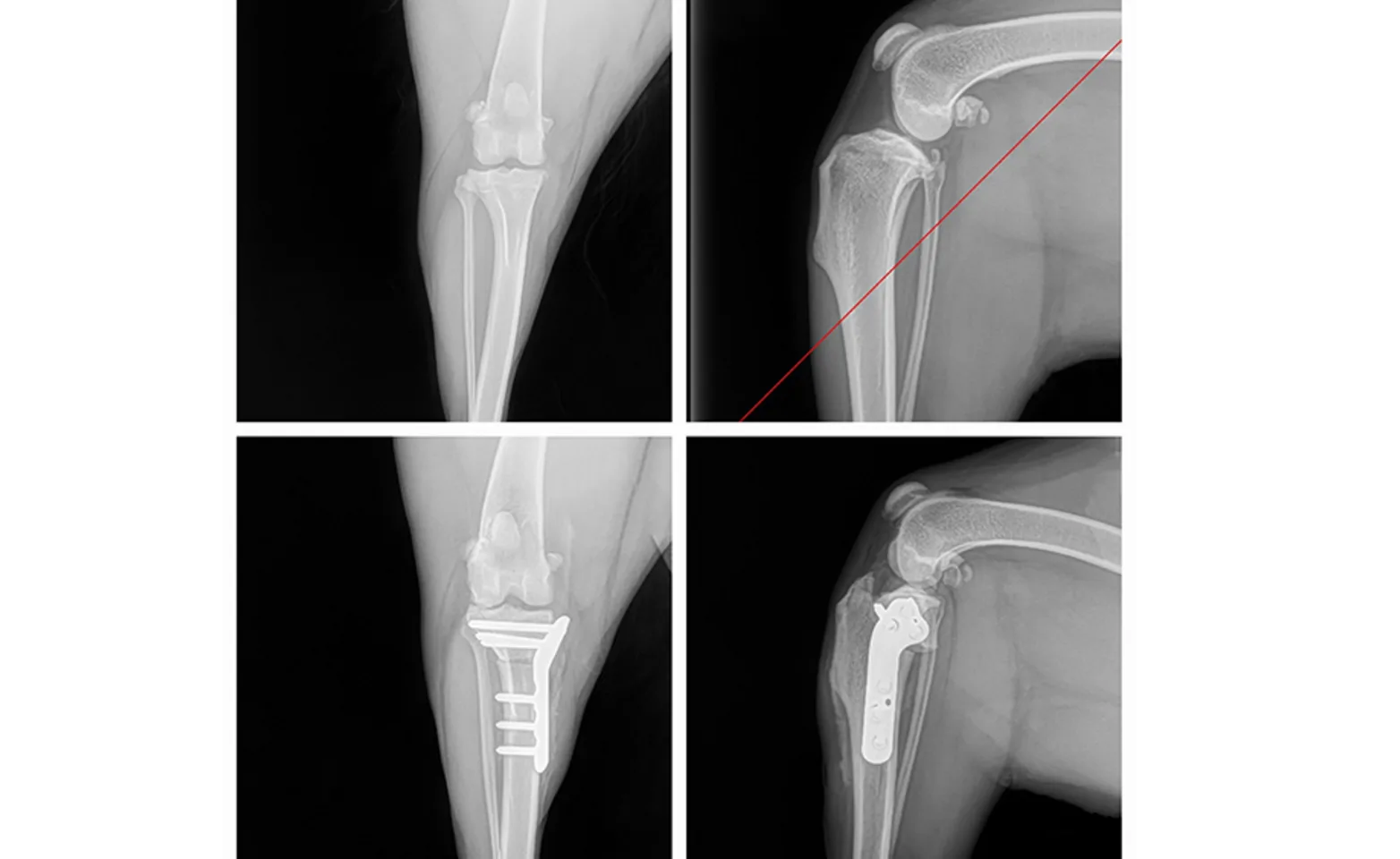 Four Pictures of Tibial Plateau Leveling Osteotomy (TPLO) X-Rays