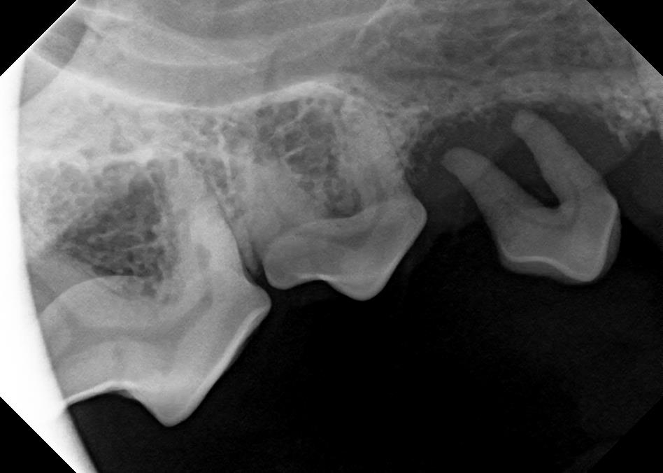 Another “floating” tooth that needs to be extracted.