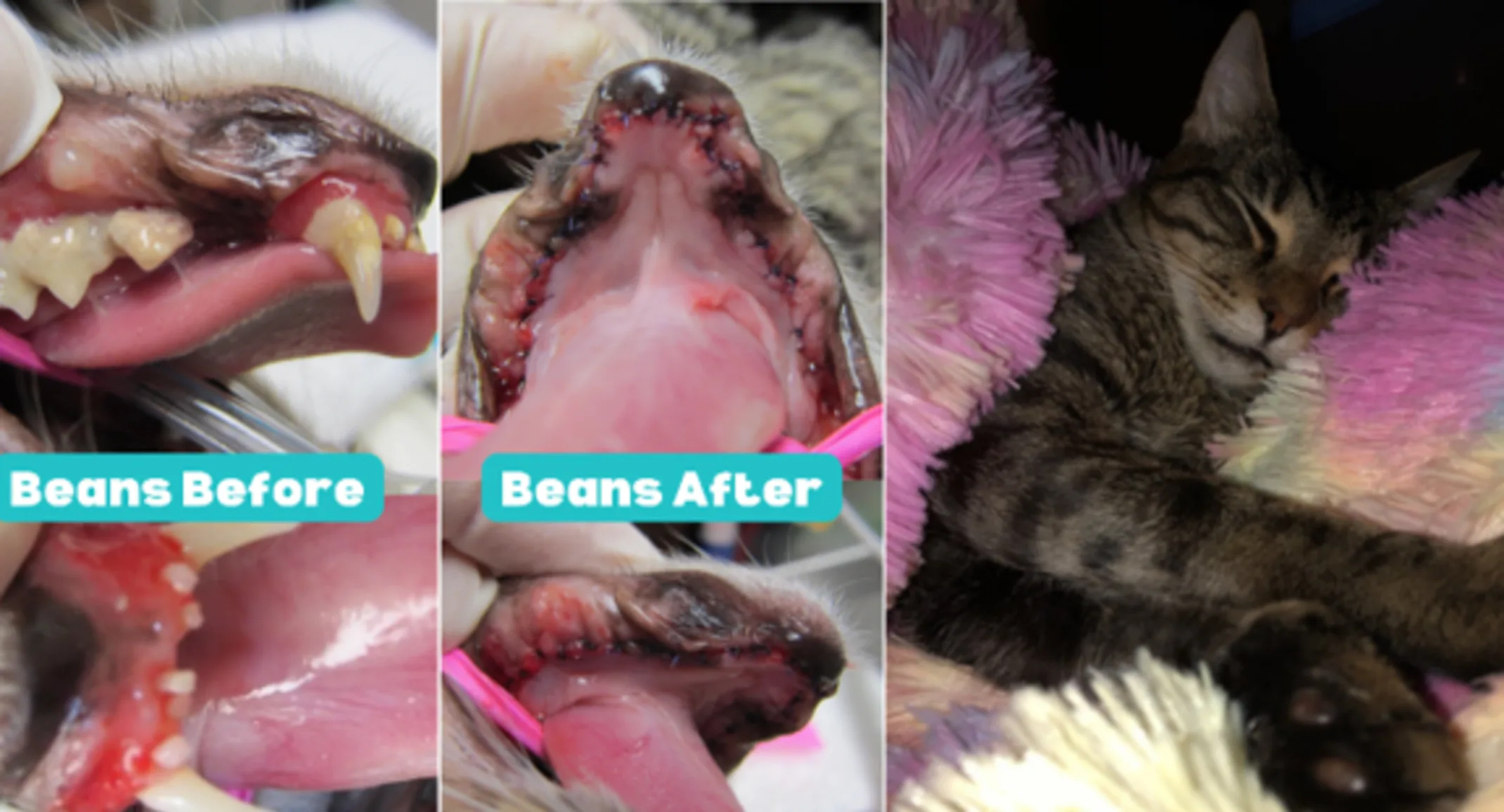 Bean's before and after dental images