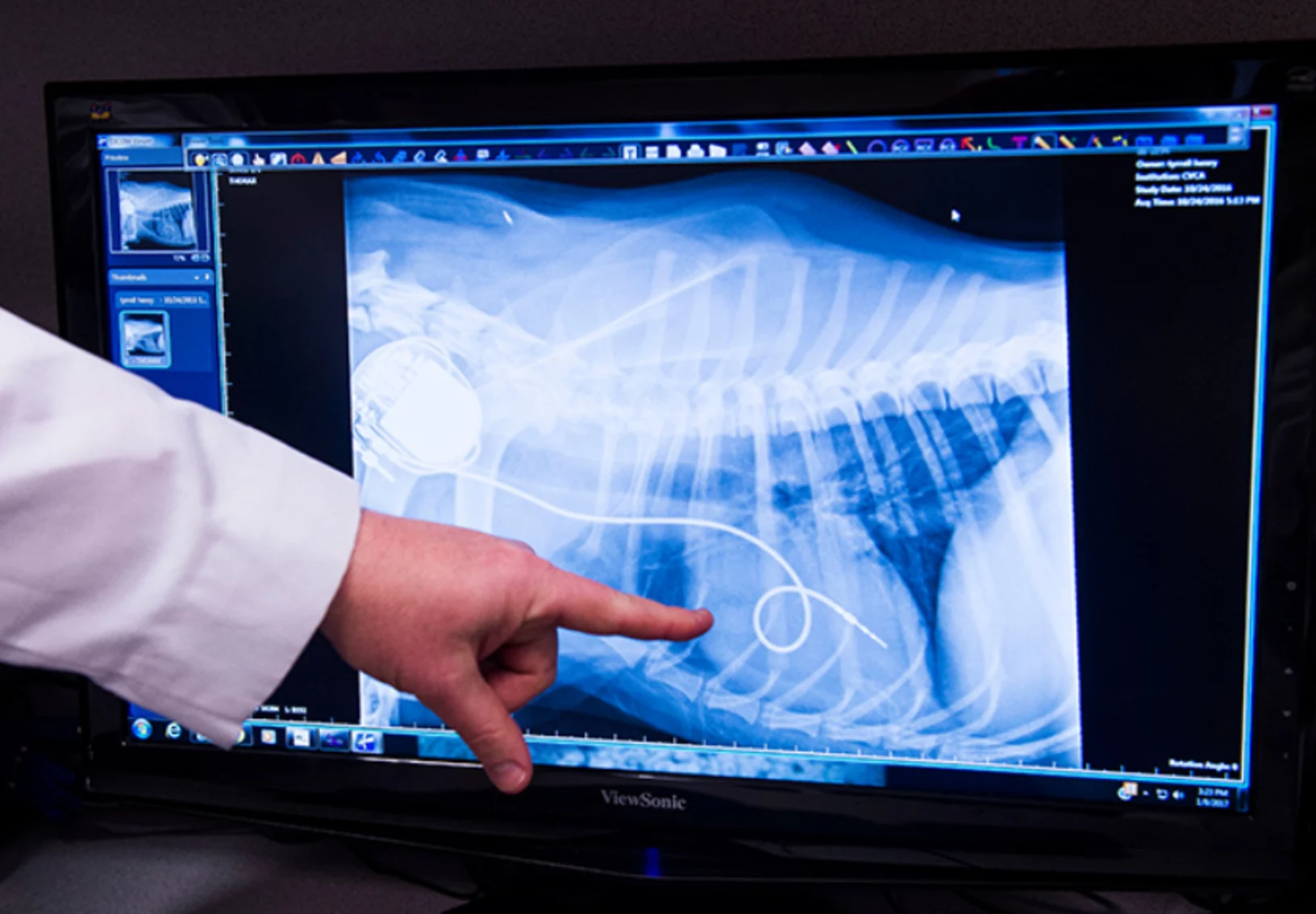 Fluoroscopy Fluoroscopy