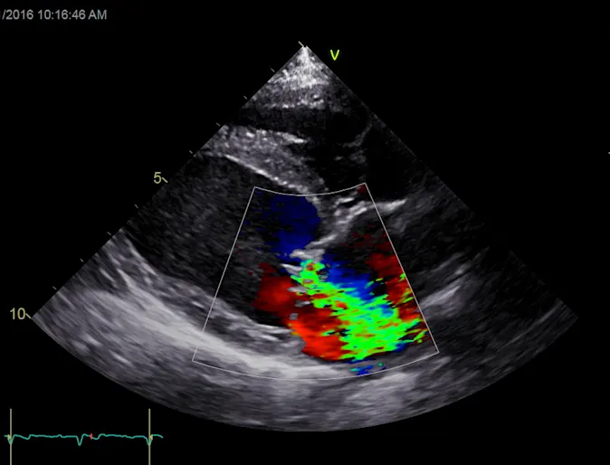 cardiology