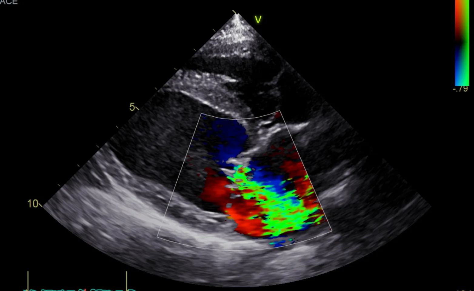 cardiology