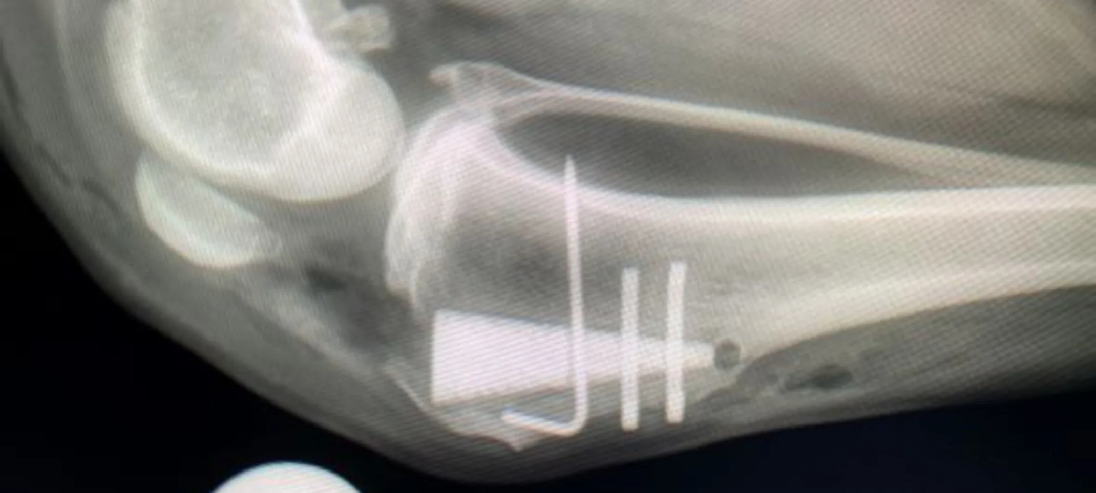 MMP TTA Procedure for Cranial Cruciate (Knee) Disease MMP TTA Procedure for Cranial Cruciate (Knee) Disease