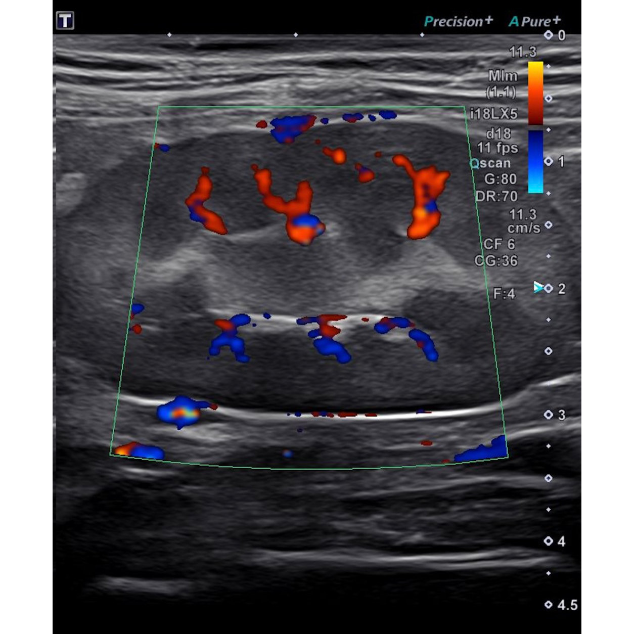 AESC Diagnostic Imaging