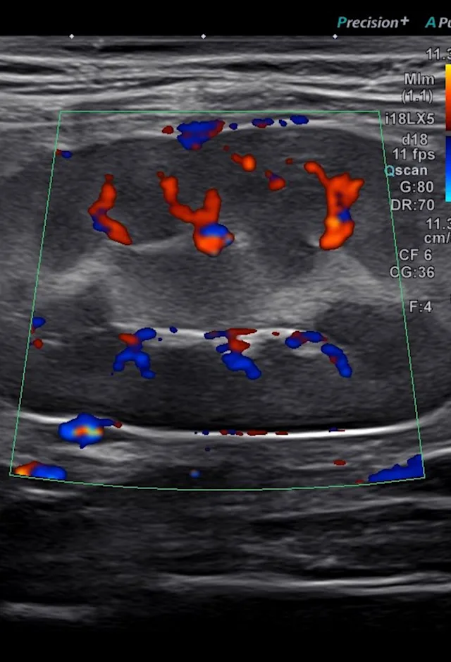 AESC Diagnostic Imaging AESC Diagnostic Imaging