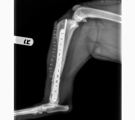 Right Tibial Orthopedic Surgery Photo Right Tibial Orthopedic Surgery Photo