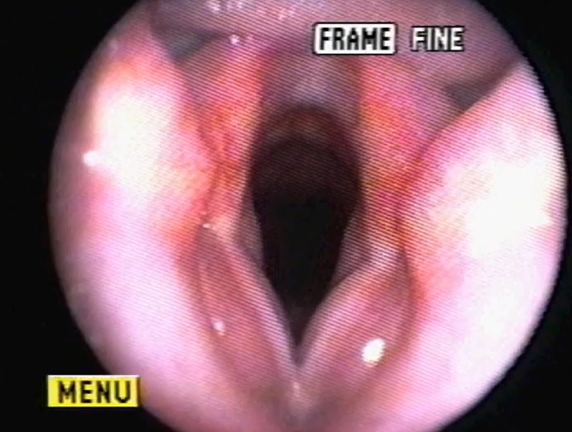 Thumbnail for a video of examination of the larynx of a normal dog. 