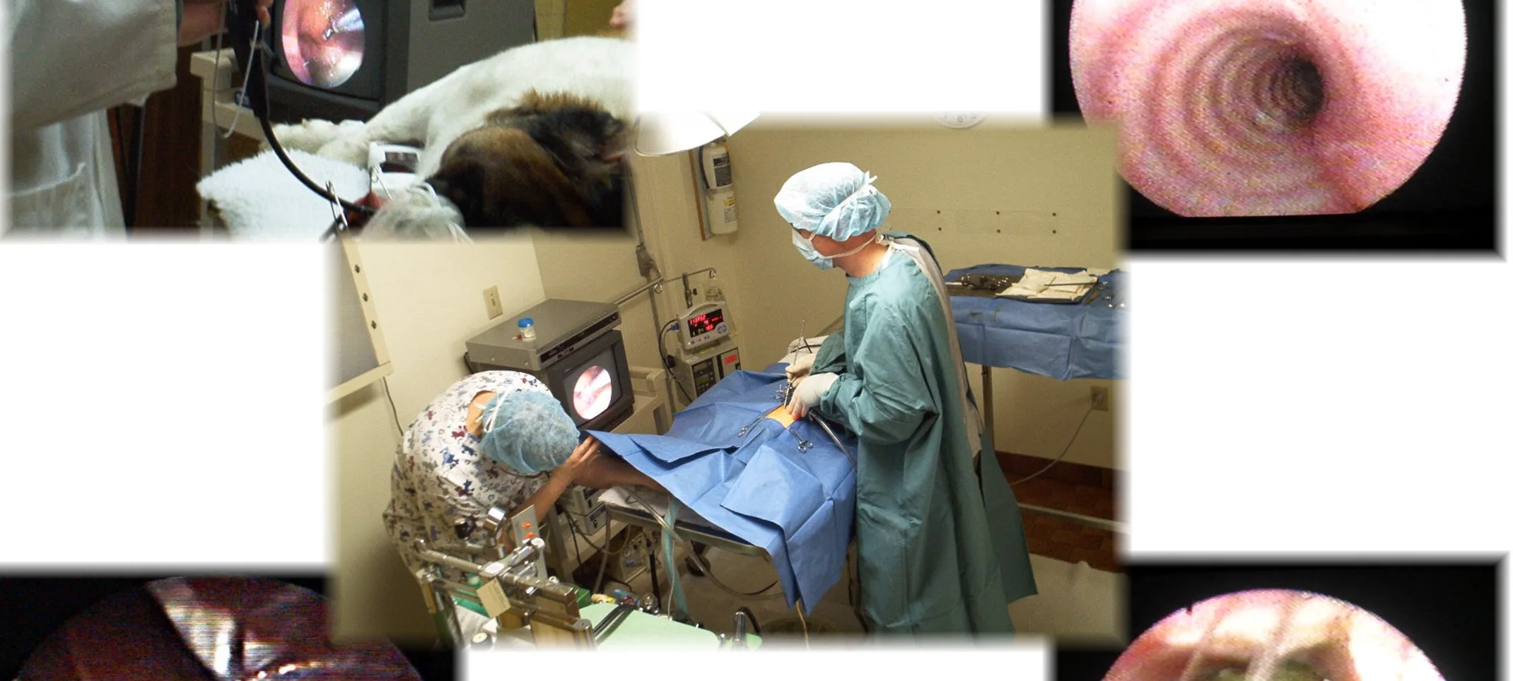 Different pictures of endoscopy procedures Different pictures of endoscopy procedures