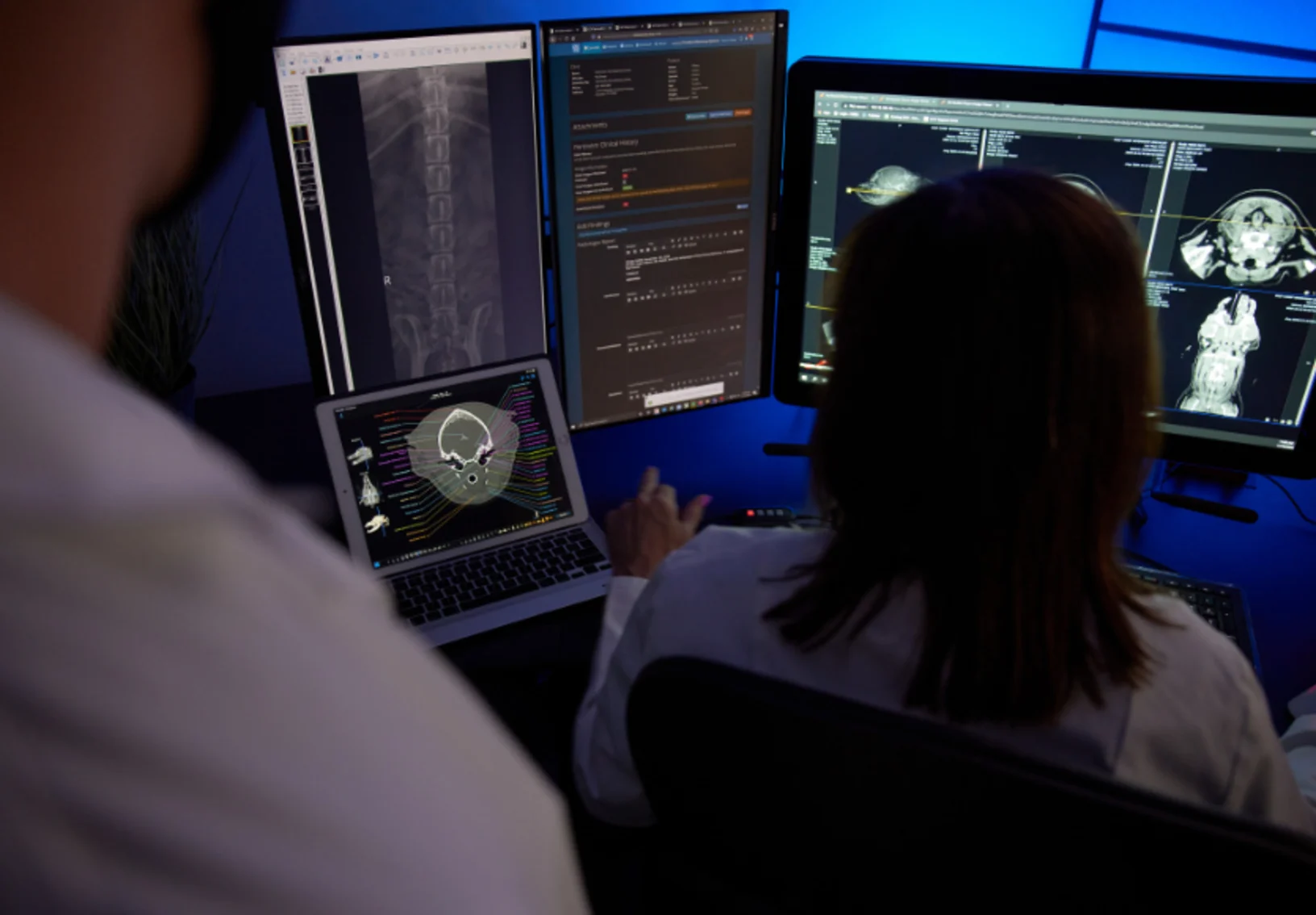 Staff member looking at radiograph images on a computer monitor Staff member looking at radiograph images on a computer monitor