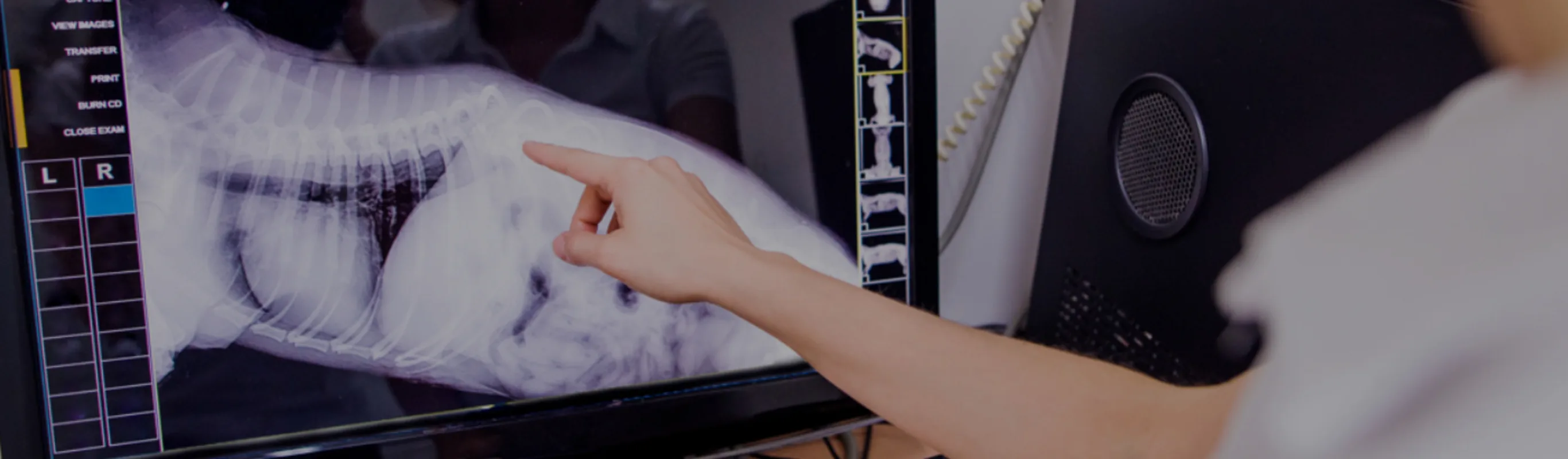 Doctor pointing at an X-ray image Doctor pointing at an X-ray image