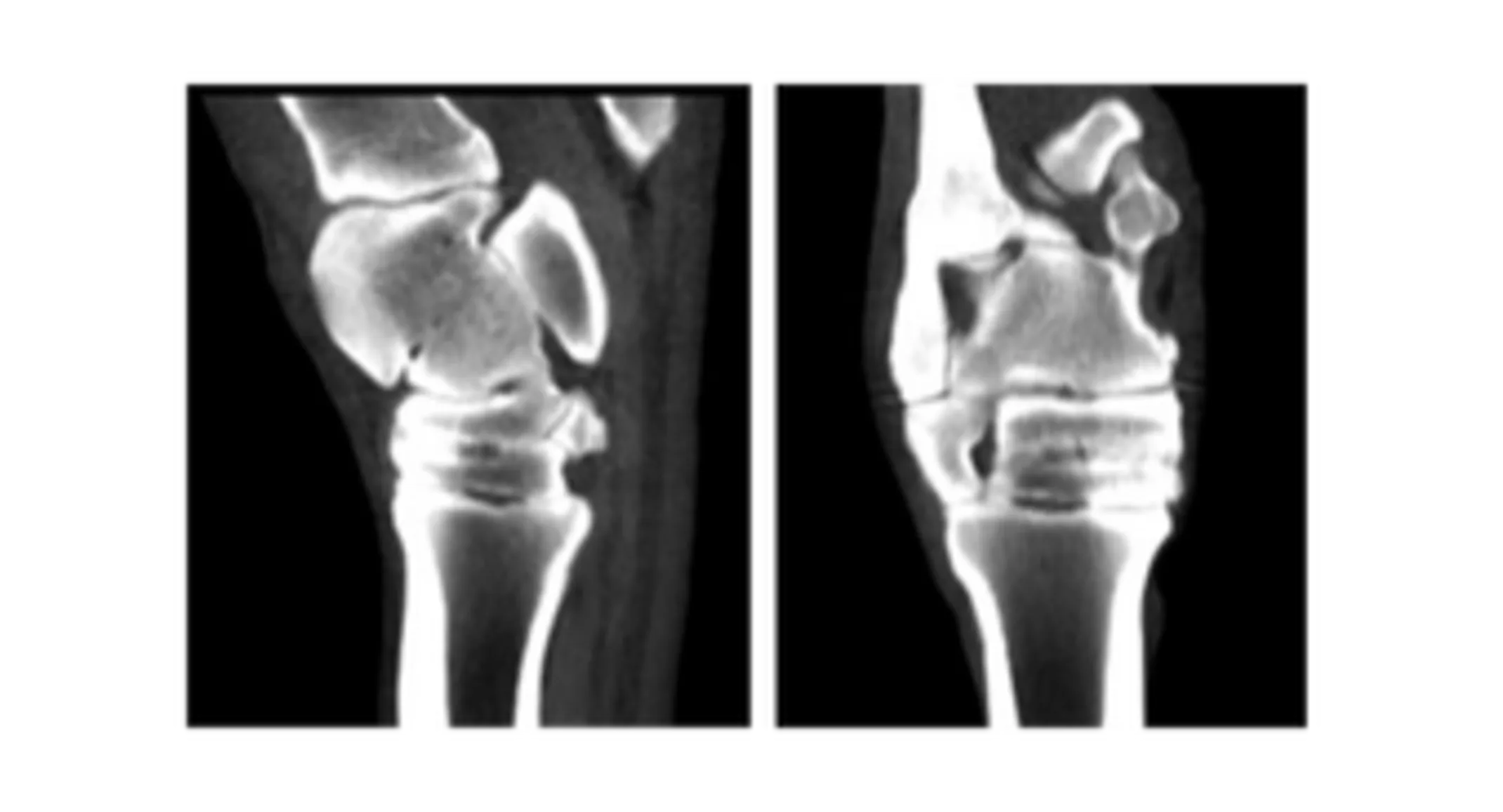 Proximal Hind Limb CT Case Study Proximal Hind Limb CT Case Study
