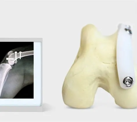 RidgeStop Procedure for Luxating Patella Image RidgeStop Procedure for Luxating Patella Image