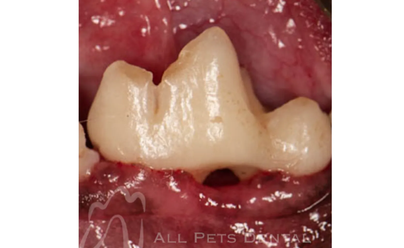 Example of Furcation Exposure Example of Furcation Exposure