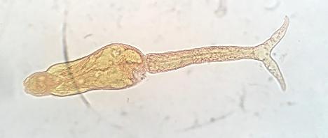 Heterobilharzia americana