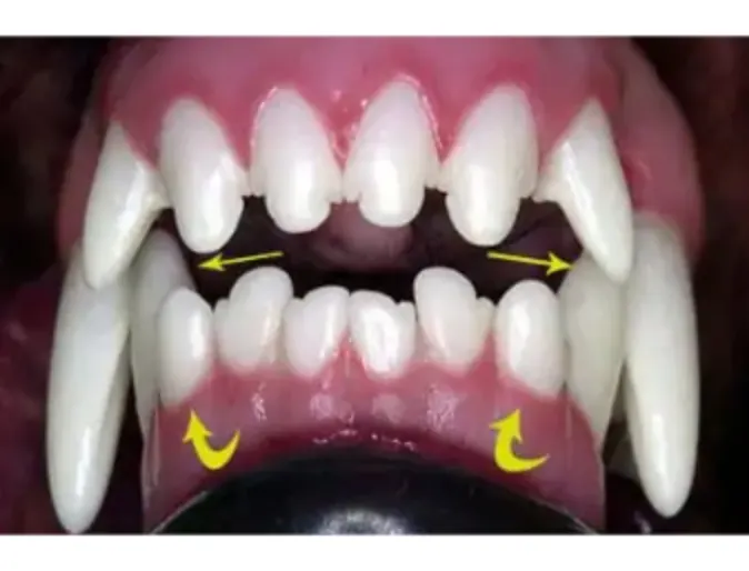 Pet's teeth with inclined plane Pet's teeth with inclined plane