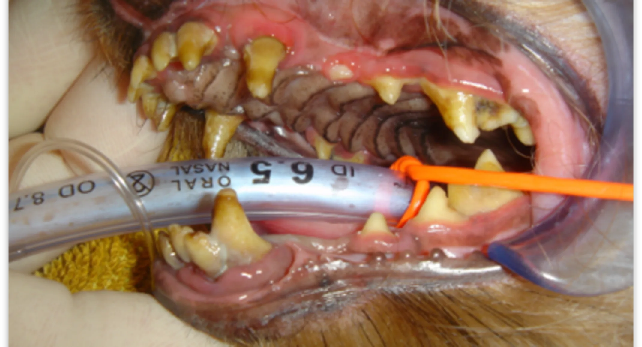Pre-operative intraoral photograph Pre-operative intraoral photograph