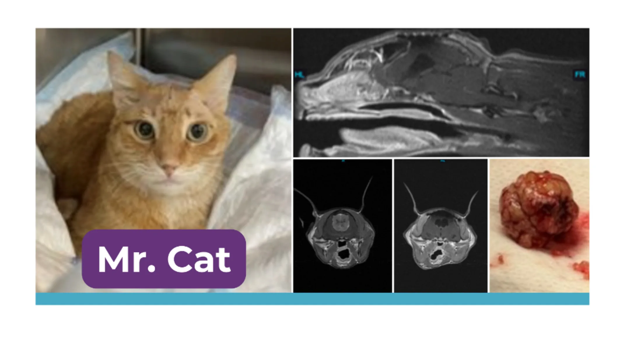 Surgical Treatment of an Intracranial Meningioma in a Cat Surgical Treatment of an Intracranial Meningioma in a Cat