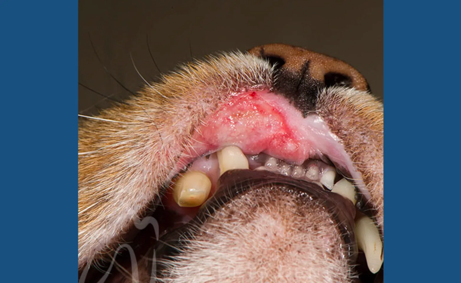 Eosinophilic Granuloma Eosinophilic Granuloma