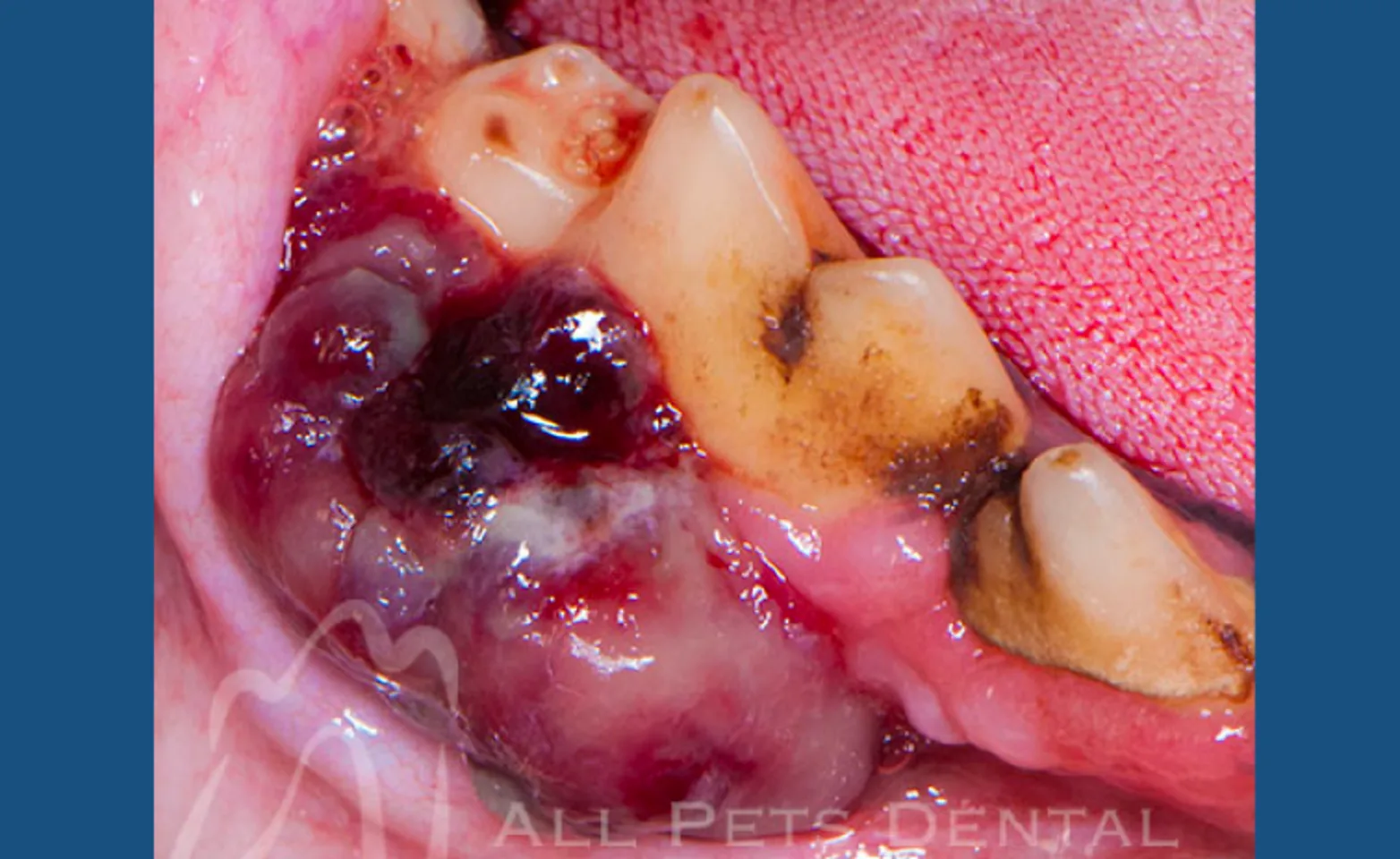 Malignant Melanoma Malignant Melanoma