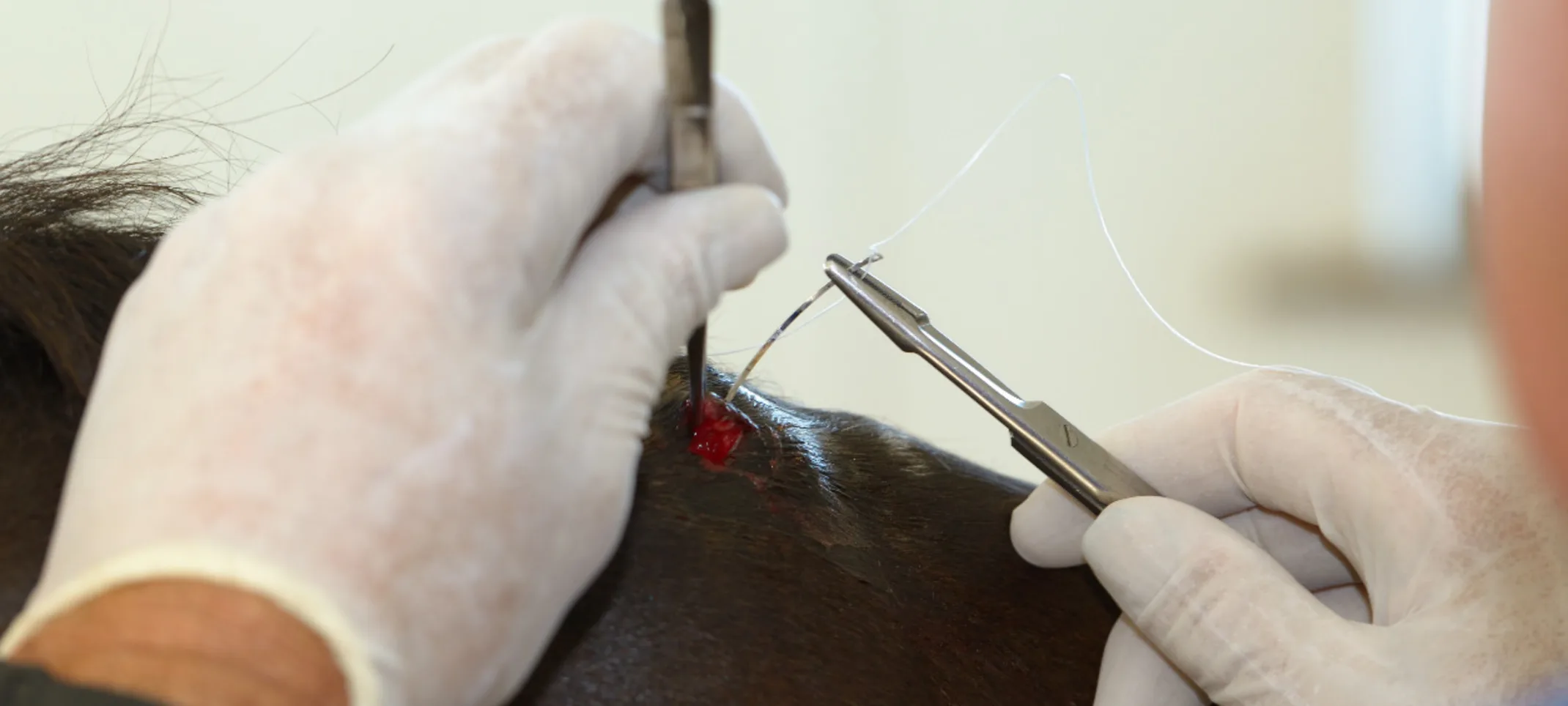 Horse veterinarian stitching a bite wound on the withers of a bay thoroughbred Horse veterinarian stitching a bite wound on the withers of a bay thoroughbred