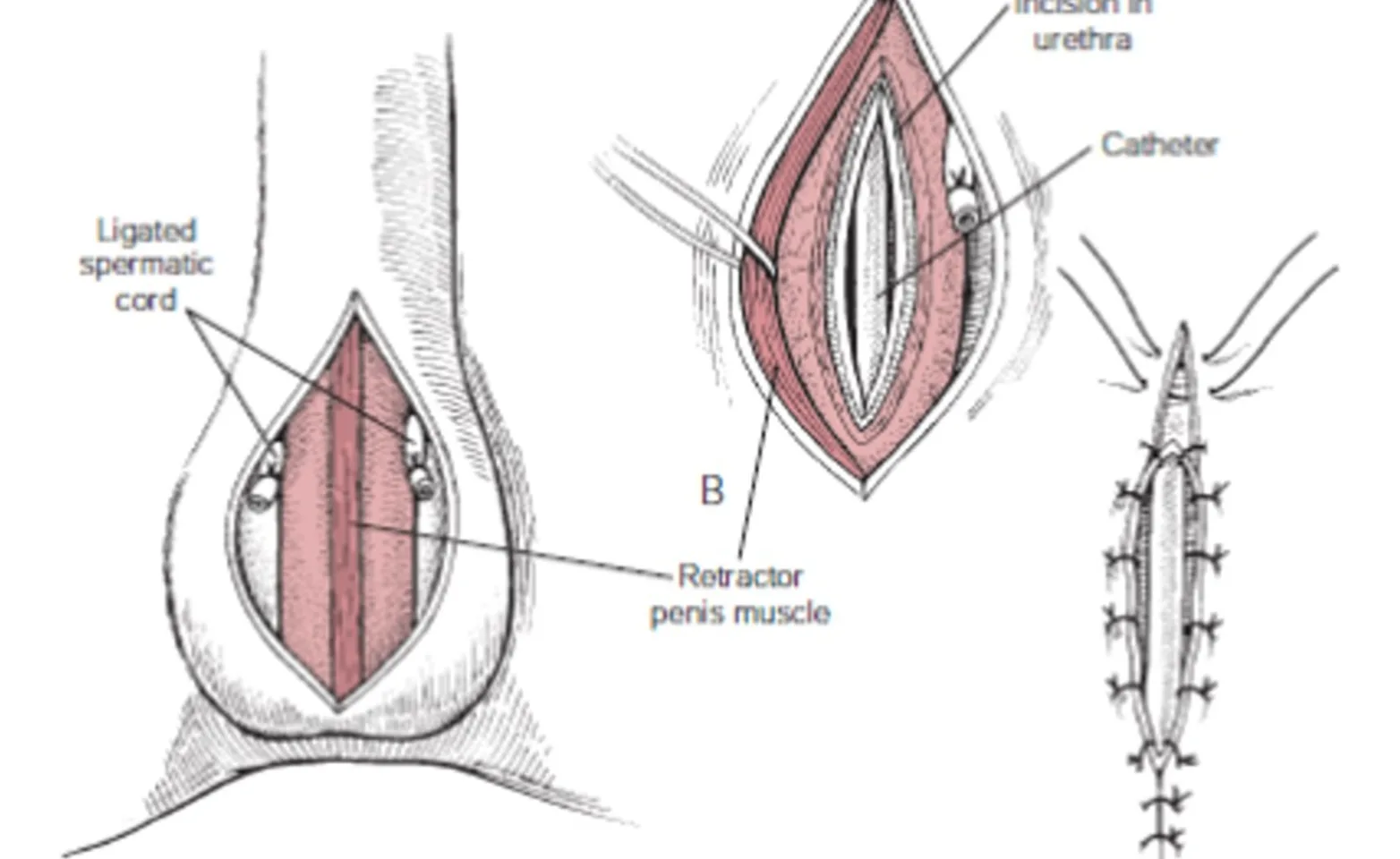 scrotal urethrostomy procedure scrotal urethrostomy procedure
