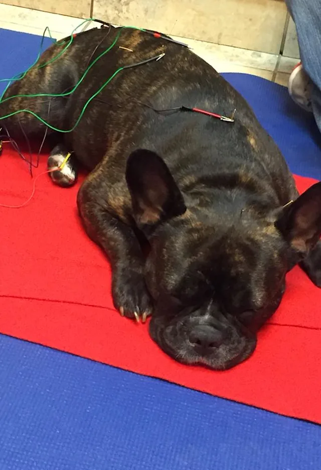 Acupuncture Acupuncture