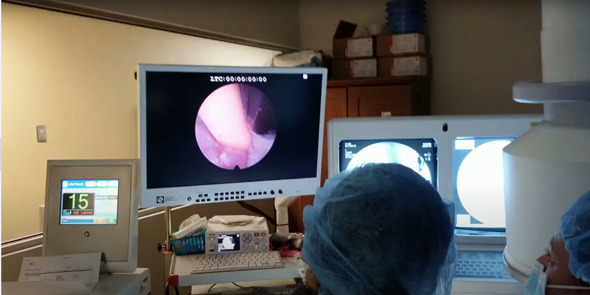 Ectopic Laser Ablation