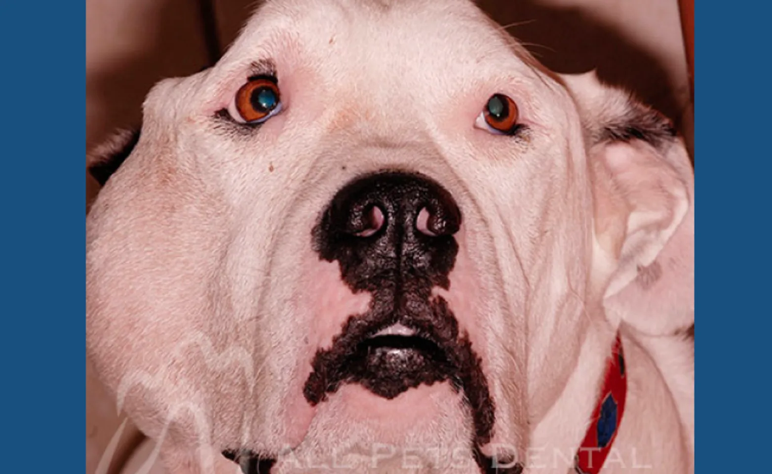 Fibrosarcoma Fibrosarcoma