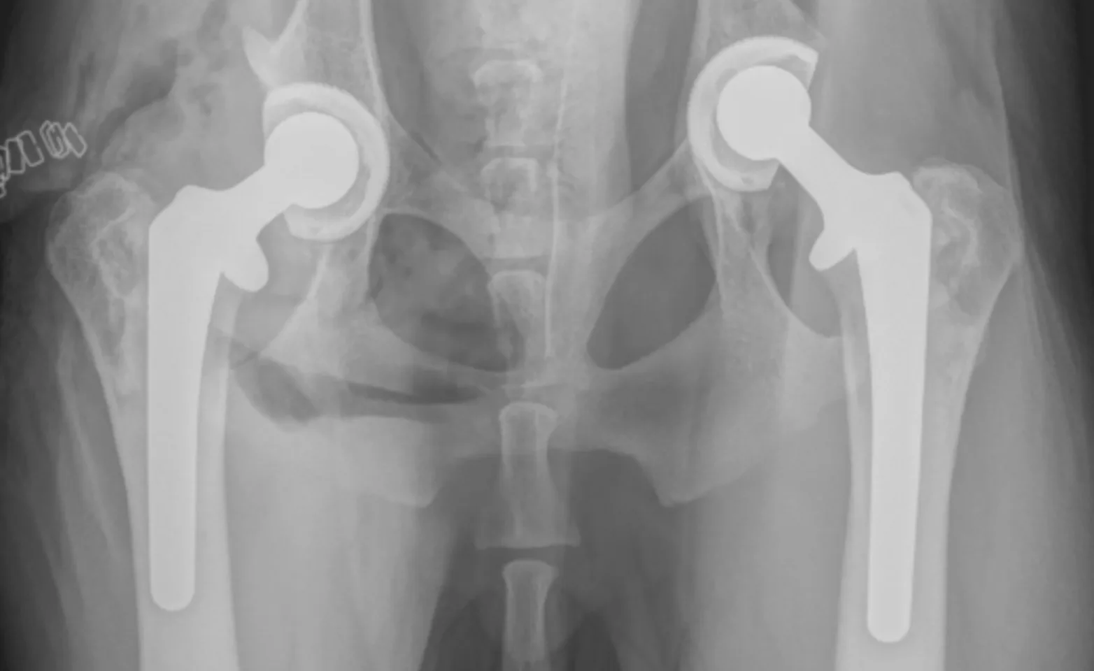 X-ray of hindlimb X-ray of hindlimb