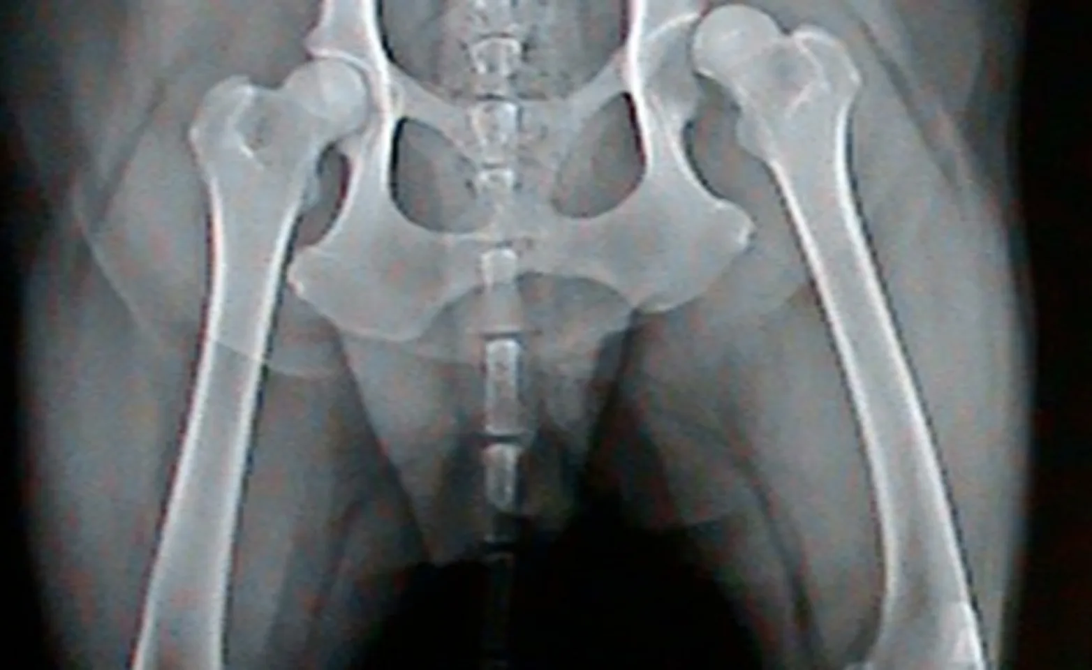 Hip x-ray of dog Hip x-ray of dog