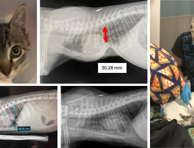 Piko's Sternal Deviation Piko's Sternal Deviation