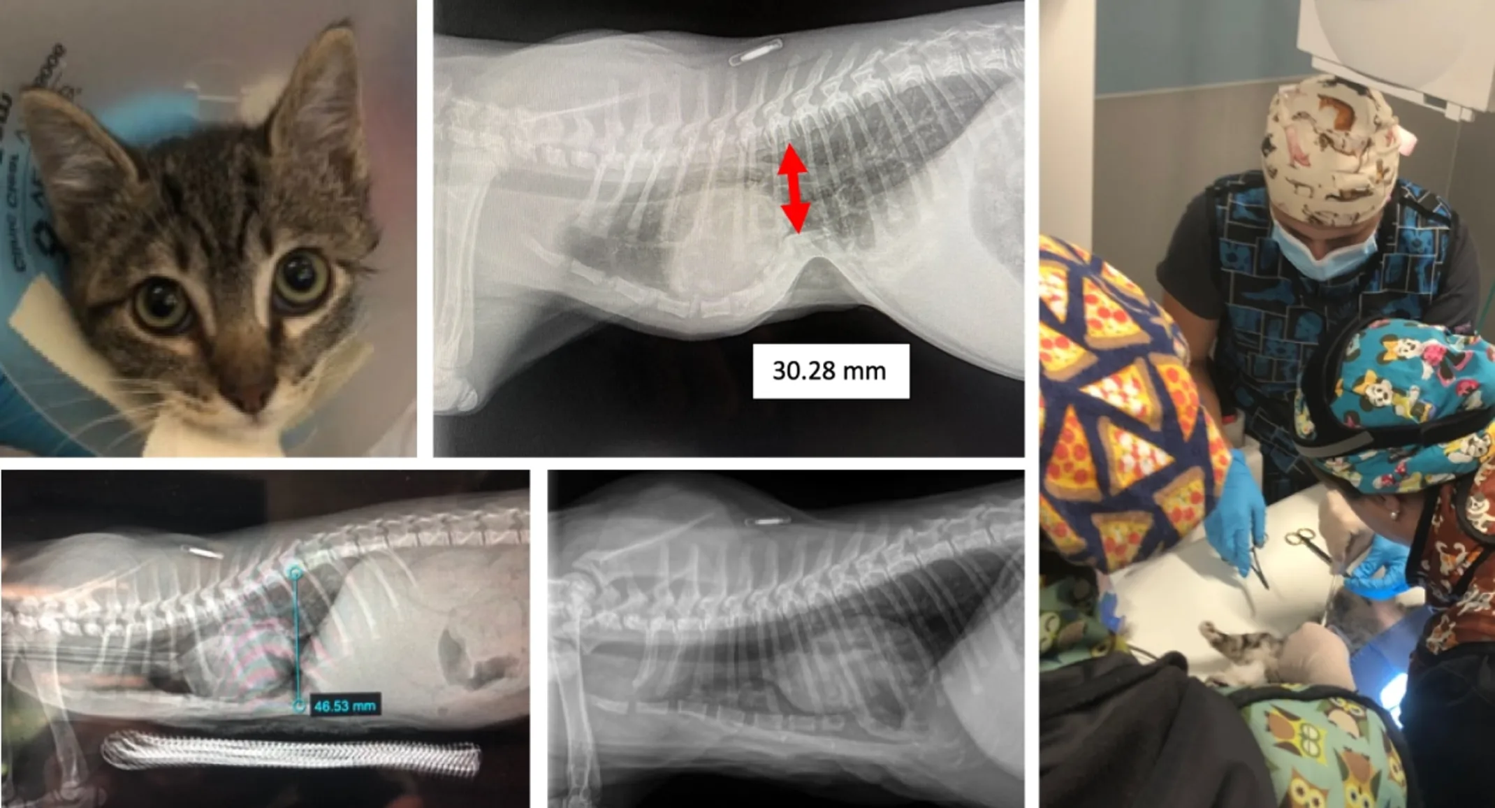 Piko's Sternal Deviation Piko's Sternal Deviation