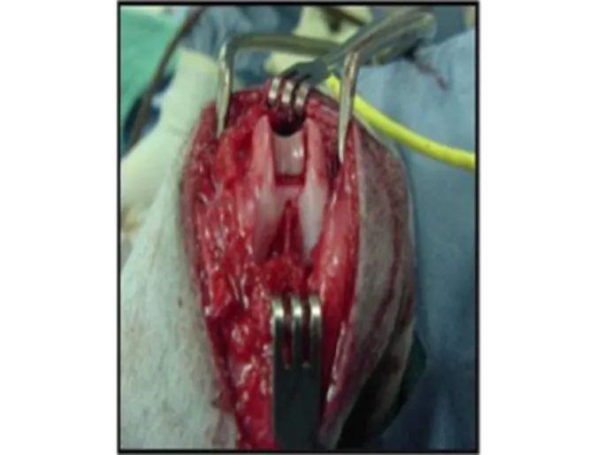 Femural groove deepening in a real stifle joint. Femural groove deepening in a real stifle joint.