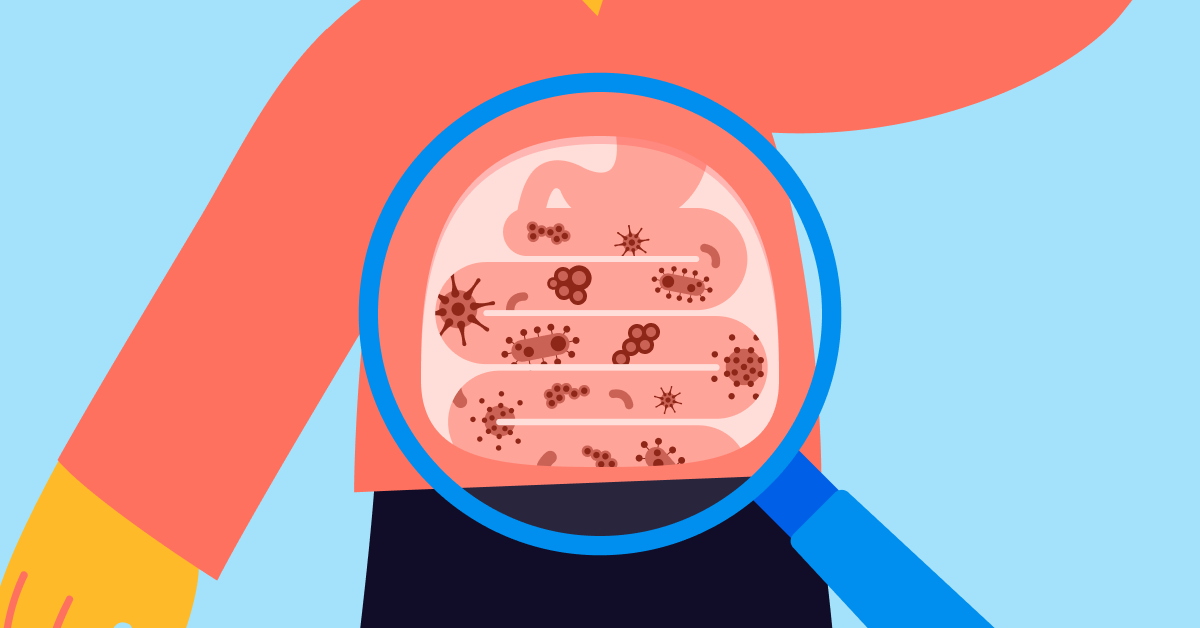 Recent studies link gut bacteria to RA development and severity Recent studies link gut bacteria to RA development and severity