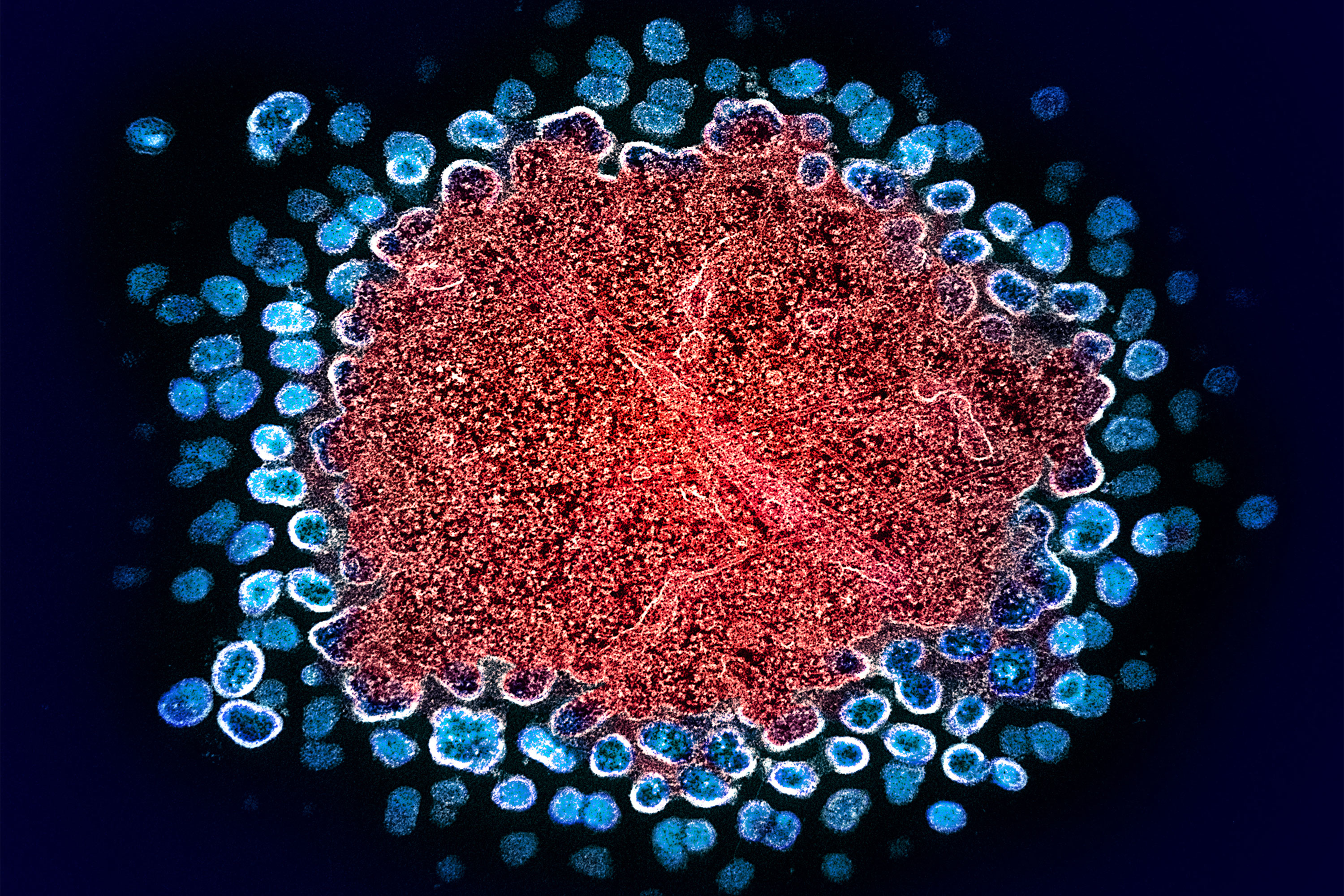 What’s the State of HIV Cure Research as 2022 Comes to an End?