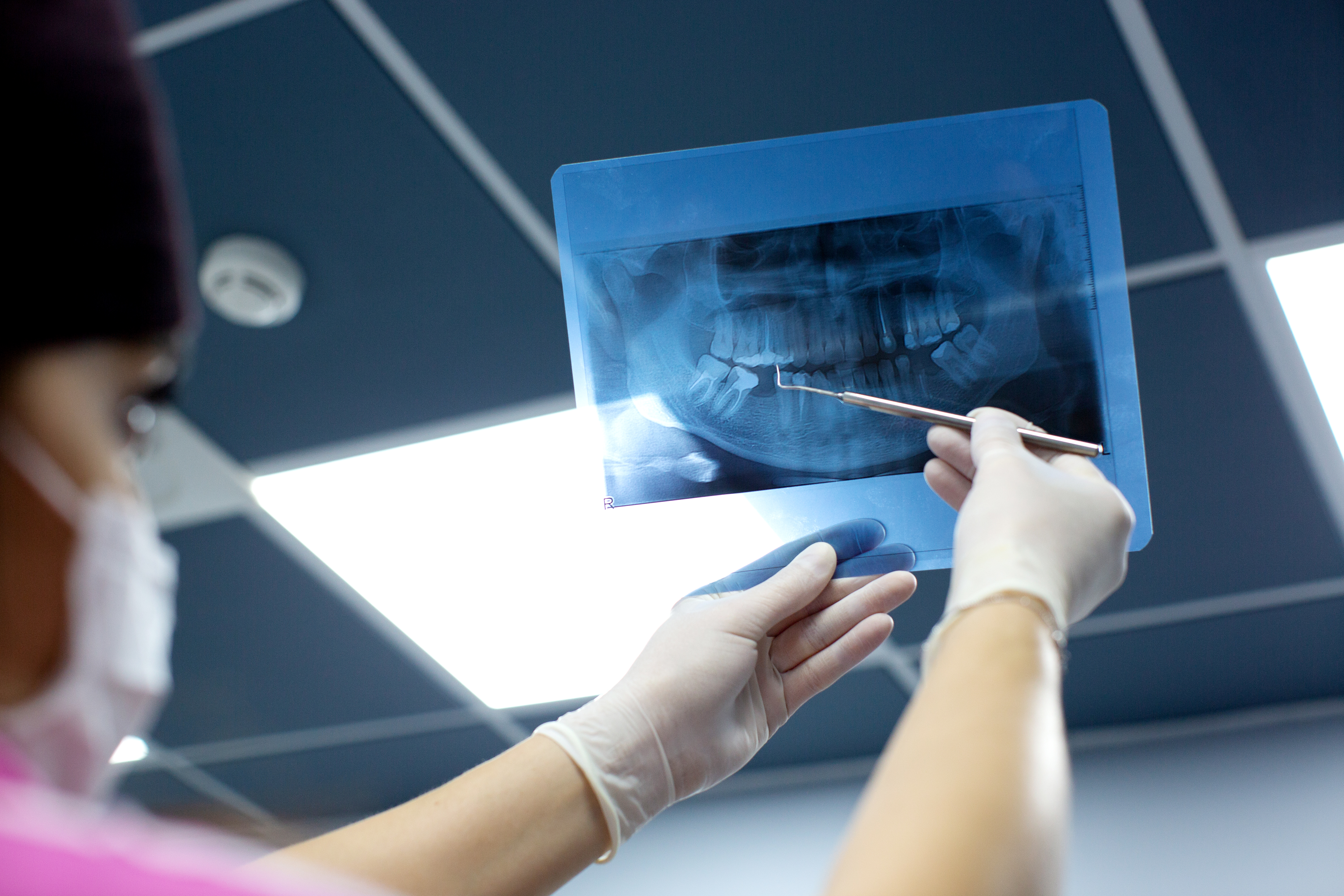 dentist-checks-x-ray-photo-mouth