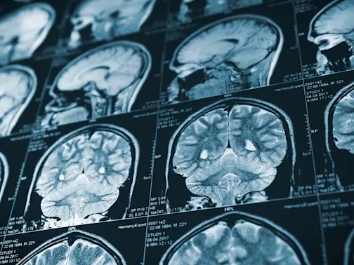 The Alarming Link Between Head Injuries and Serial Killers-1
