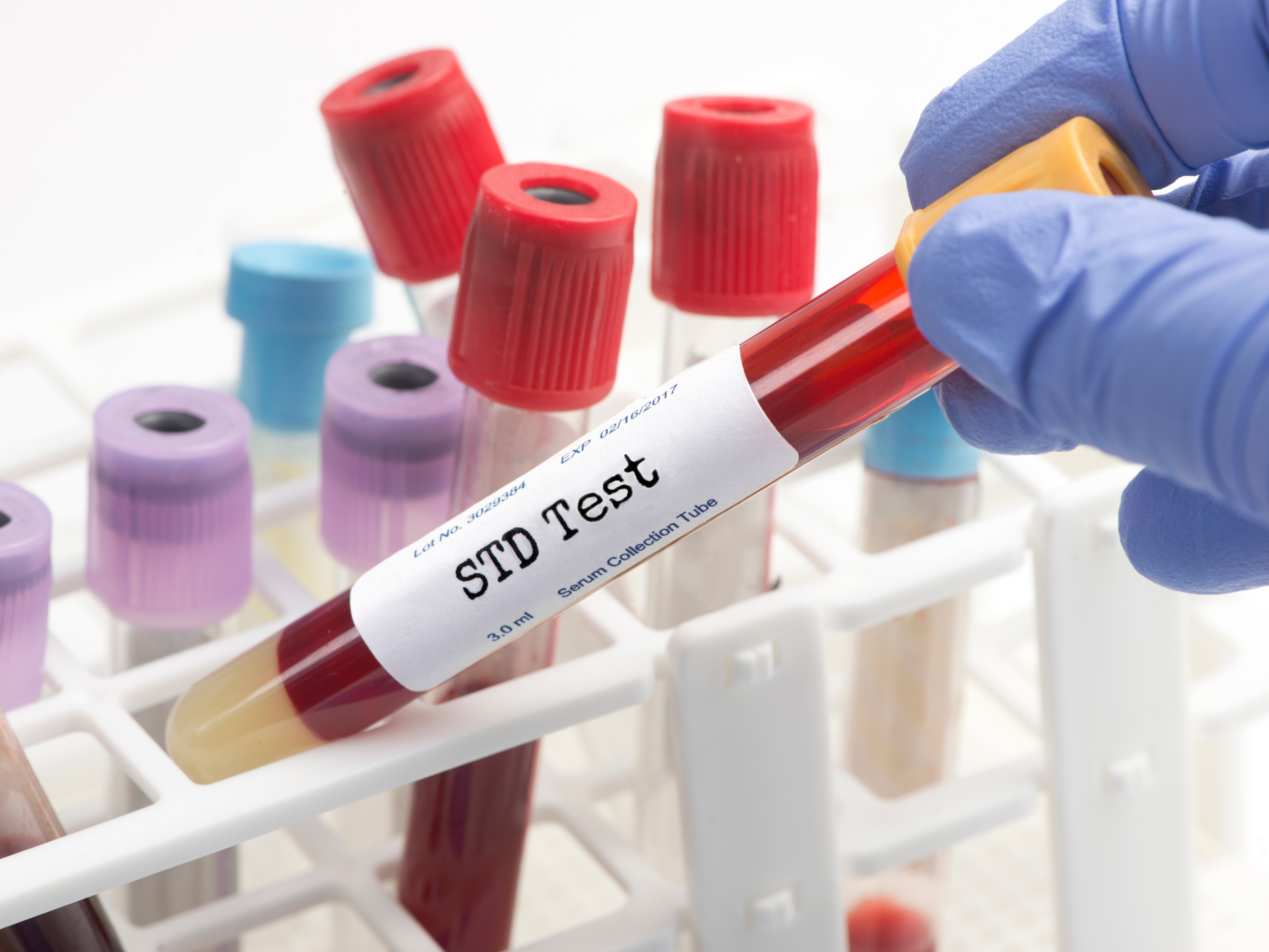 AdobeStock 103144889