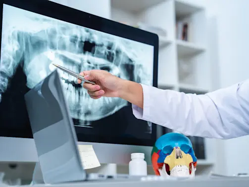 Scientists Just Found a Startling New Cause of Alzheimer’s — It’s in Your Mouth!-1