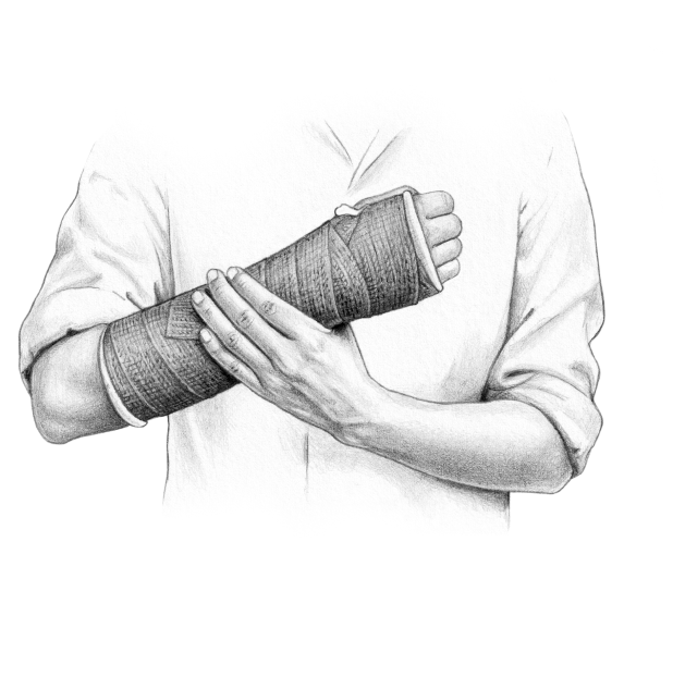 A illustration of a person holding their broken wrist.