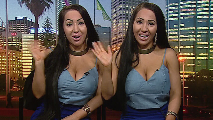 Meet The Worlds Most Identical Twins Who Share One 