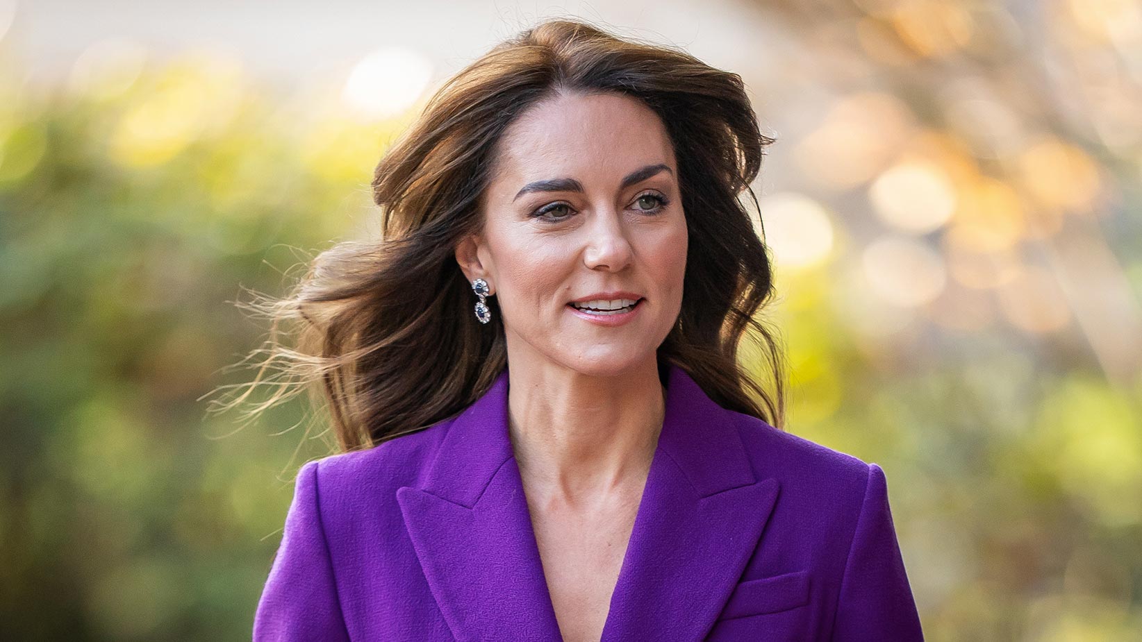 Kate Middleton in hospital after undergoing abdominal surgery | This ...
