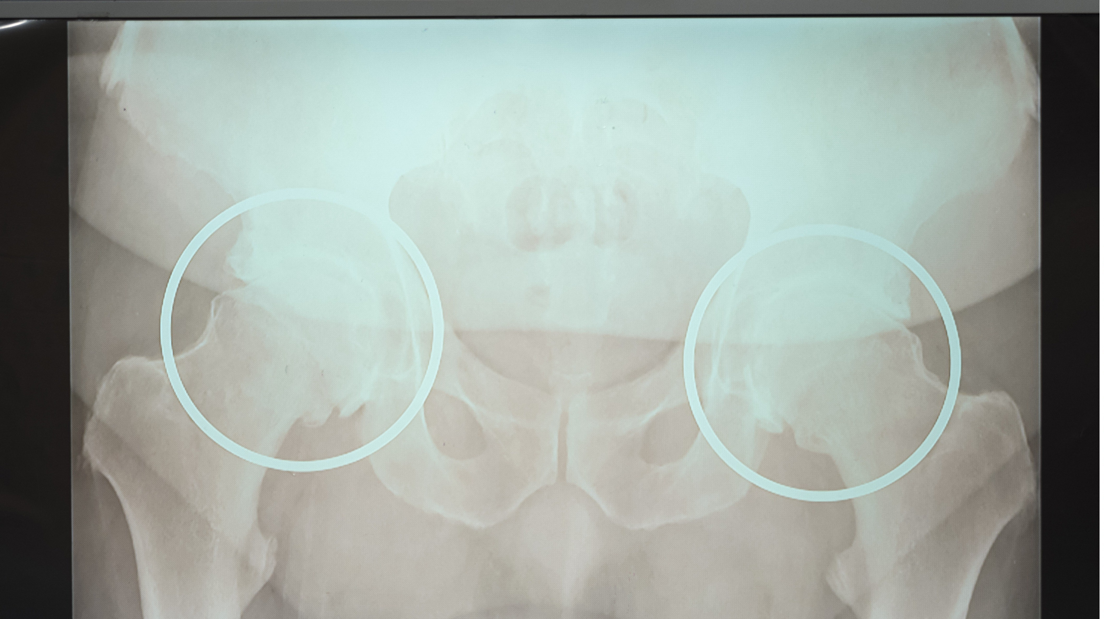 Send your messages to Eamonn before his op | This Morning