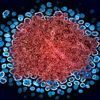 A micrograph of HIV particles replicating