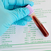 New Ideas About CD4 Cell Counts and When to Start Treatment
